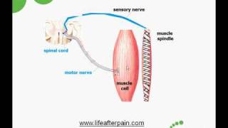 Myofascial Trigger Points Causes and Treatment [upl. by Einohpets]