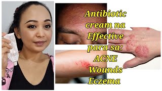 Antibiotic Cream na Effective treatment  Para sa Wounds ACNE at Eczema [upl. by Imhsar]