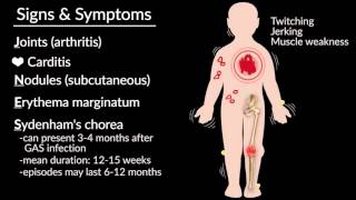 Acute Rheumatic Fever by E Rusingiza  OPENPediatrics [upl. by Enylecoj]