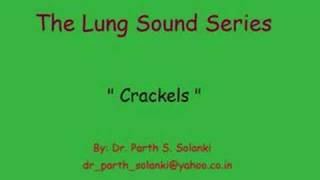 Breath Sounds  Crackels [upl. by Kleinstein]