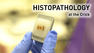 What is histopathology [upl. by Laurence]