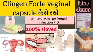 clingen Forte veginal capsule kaise rakhe [upl. by Ymmat204]