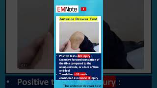 Anterior Drawer Test Knee ACL Injury doctor nursing [upl. by Albrecht]