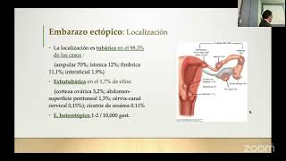 Manejo Laparoscópico del Abdomen Agudo Quirúrgico VI SC SOPEG 161024 [upl. by Rehttam247]