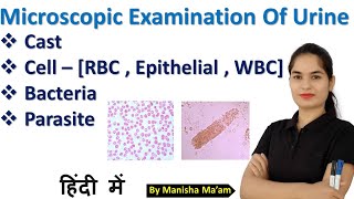 Urine Examination Part4  Microscopic examination of urine  Urinalysis urine examination in hindi [upl. by Sadoff]