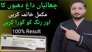 How to get rid of face melasma and dark spots  face whitening cream  Dr review white essence [upl. by Atelokin]