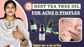 Top 3 Tea Tree Oil  For Acne amp Pimples  Correct Way to use on Face  Dr Arwa Bohra [upl. by Nylirem829]