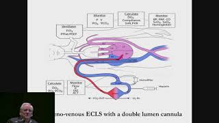 Why VV ECMO Must be Looked at Differently [upl. by Landmeier68]