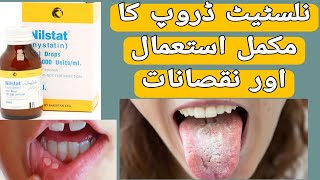 Nilstat Drops Uses  Nilstat Drops Side Effects  Mouth ulcer  Nystatin Uses in UrduHindi [upl. by Arymahs462]