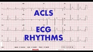 ACLS  ECG rhythm recognition amp management Part 1 [upl. by Asreht]