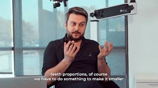 The Ultimate Guide to NonPrep Dental Veneers Everything You Need to Know [upl. by Trebor]