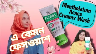 একনি ফেসওয়াশ  Acne Facewash Mentholatum Acnes Creamy Wash Review Video [upl. by Rimidalg]