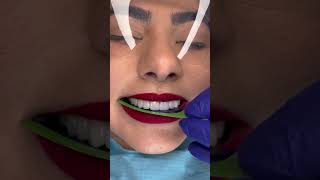 Does anyone know why people bite filmfullingDIYdentist badbreath shame🦷beadrepair [upl. by Rriocard]