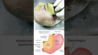 Attachment of lesser omentum on to the liver shorts anatomy biology [upl. by Rosenwald]