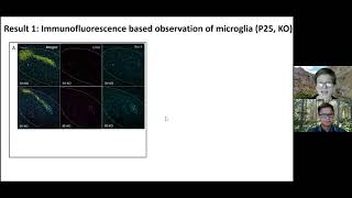 Microglialmediatedphagocytosis underlies presentation by Lara RogersonWood [upl. by Ahern]