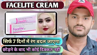 Facelite cream uses dose benefits and Side effects full review in hindi [upl. by Gronseth485]