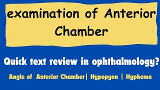 Anterior chamber of eye  Anterior segment examination  Anterior chamber angle OptometryFans [upl. by Neelloc]