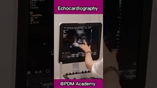 Echocardiography  an ultra sound for heart ❤️  Test and procedure [upl. by Rashidi591]