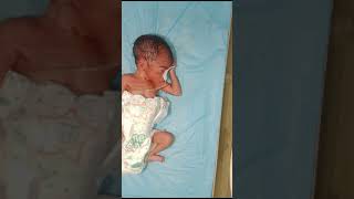 obed This newborn baby Hypotonia lack of healthy mother this newborn baby very thin body [upl. by Calore331]