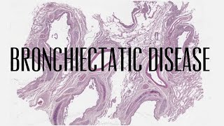 4 Bronchiectatic disease [upl. by Edyaw]