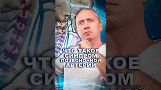 Синдром Позвоночной Артерии  Скрытый убийца здоровье шишонин [upl. by Eiramyelhsa]