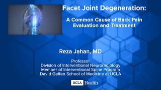 Facet Joint Degeneration A Common Cause of Back Pain Evaluation and Treatment [upl. by Ivek]