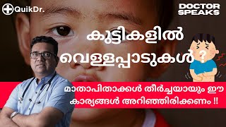 കുട്ടികളുടെ മുഖത്ത് വരുന്ന വെള്ളപ്പാടിന്റെ കാരണങ്ങളും പരിഹാരവും White Patches on Baby s Face [upl. by Elliot]