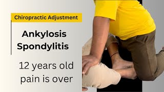 Ankylosing Spondylitis  Symptoms and Treatment Rheumatologist [upl. by Shute]