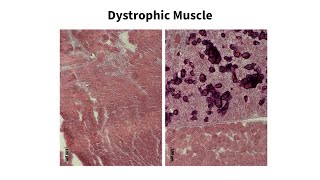 Neuromuscular Research Dr Melissa Spencers Lab [upl. by Yeleen]