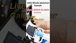 Ultrasound whole abdomen Female organs  USG IMAGES youtubeshorts7 June 2024 [upl. by Val]