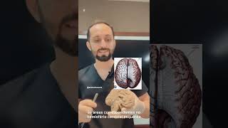 Como os hemisférios cerebrais se comunicam👀🧠 anatomia neuroanatomia corpocaloso [upl. by Bellew]