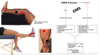 NMES amp Russian Stimulation EXPLAINED  Theory Use amp Parameters [upl. by Ravid]