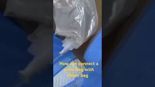 How can Connect a urine bag with Drain bag hospital infusionpump hematuria uremic fluidoverload [upl. by Aicilec161]