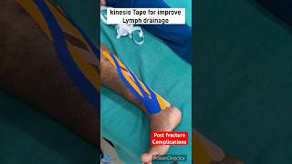 Kinesio taping for improve lymphatic drainage How to reduce edema kinesiotape kinesiotherapy [upl. by Lilybelle703]