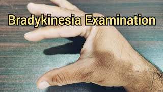 How to Examine a Patient for Bradykinesia  Parkinsonism [upl. by Lledra]