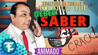 ¿Fractura de tobillo ¡Mira este video  Todo lo que debes saber sobre fracturas de tobillo [upl. by Housum]