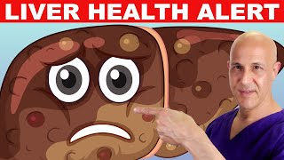 Avoid 1 Food Thats Making Your LIVER Sick Dr Mandell [upl. by Harlene909]