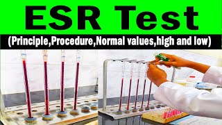 Erythrocyte sedimentation rate  ESR PrincipleProcedureNormal valueshigh and low [upl. by Oned]