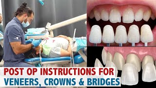 Post Op Instructions for Veneers Crowns amp Bridges [upl. by Nevaed]