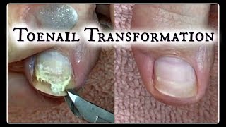 Pedicure Tutorial Toenail Transformation and Time Saving Tips ✔ [upl. by Nehemiah]