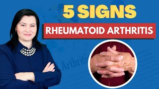 5 Signs of Rheumatoid Arthritis That You Should Not Ignore [upl. by Enyal84]