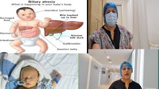 बच्चें को Biliary Atresia बीमारी Drने संभावना बताई preeti k vlogs vlogs 🏥🤱 [upl. by Abdu161]