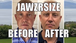 Jawzrsize Before and After  Do Jawline Exercises Work Eric West Review [upl. by Zeena453]