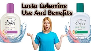 Lacto Calamine Face Lotion Use And Benefits trending trendingvideo viralvideo video viralvideos [upl. by Nashom606]