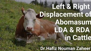 Displacement of AbomasumLDARDATreatment protocolComplete Lecture By Dr Hafiz Nouman Zaheer [upl. by Alleahcim]