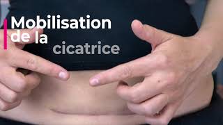 Automassage de votre cicatrice de césarienne  5 techniques de massage en temps réel Kiné Postpartum [upl. by Fancie]