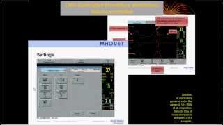 Mechanical ventilation20 weaning1 English [upl. by Aleyam]