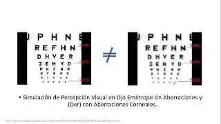 Aberrometría parte 1  Dr Juan Felipe Robayo [upl. by Odinevneib]