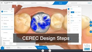 CEREC Software 5 Step Design Workflow [upl. by Issiah533]