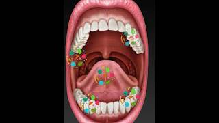 பல் சொத்தை அனிமேஷன் Tooth Decay animation [upl. by Aihselat766]